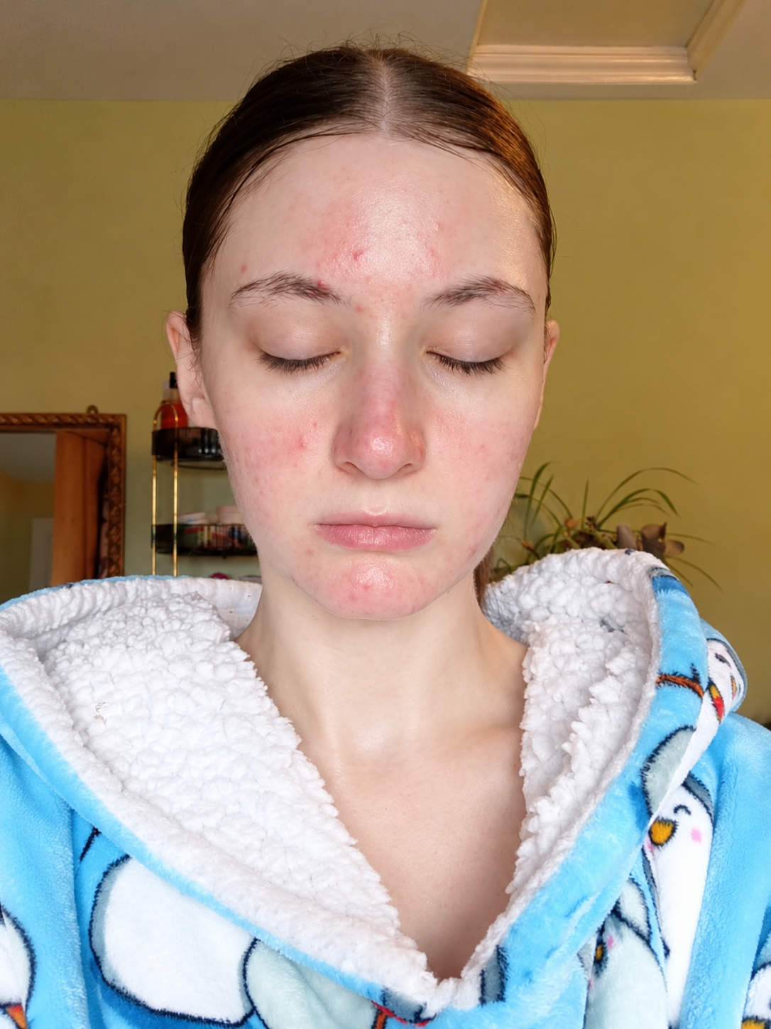 After treatment result 2