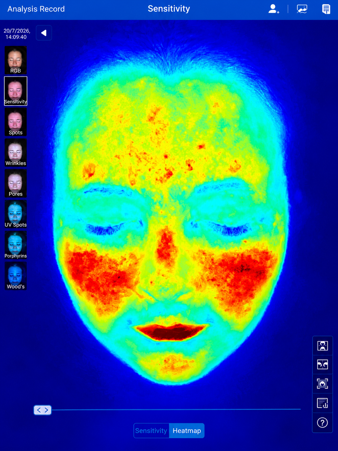 Before treatment result 1