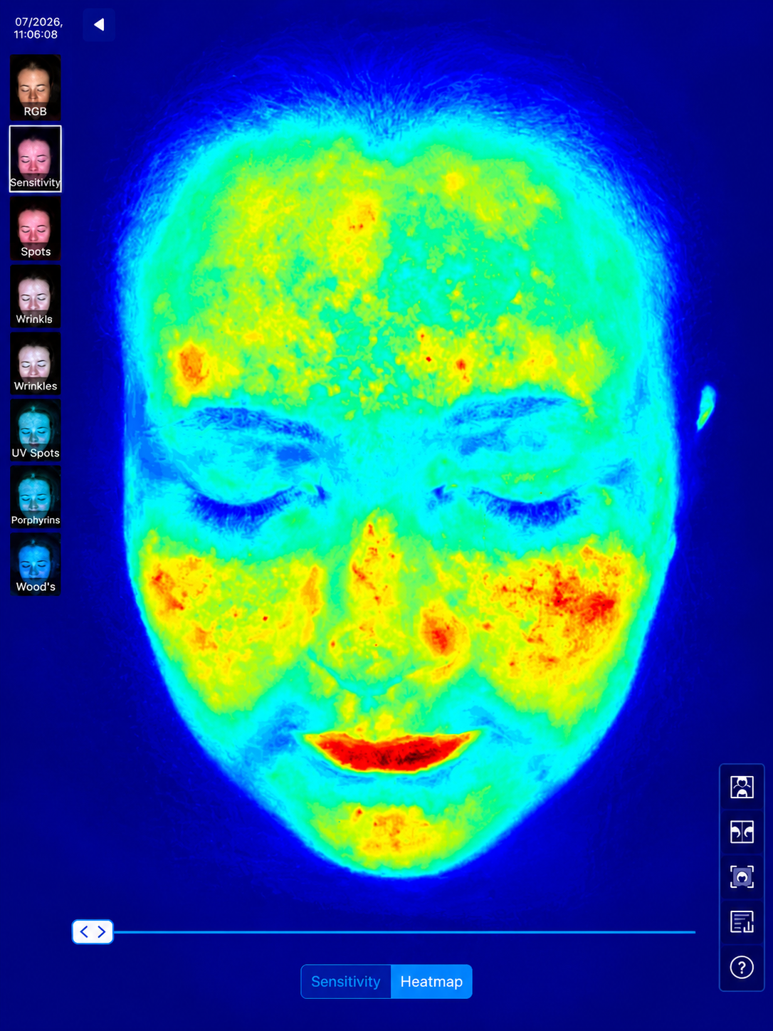 After treatment result 1